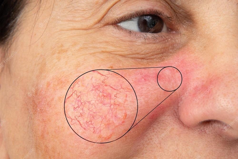 Best Cancer Treatment in India 3 2630633