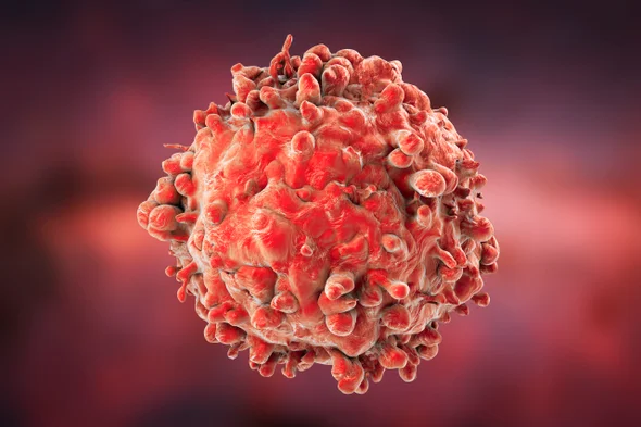 Best Cancer Treatment in India 6 9347BD0E 72A4 47A9 B24292E3941BC147 source