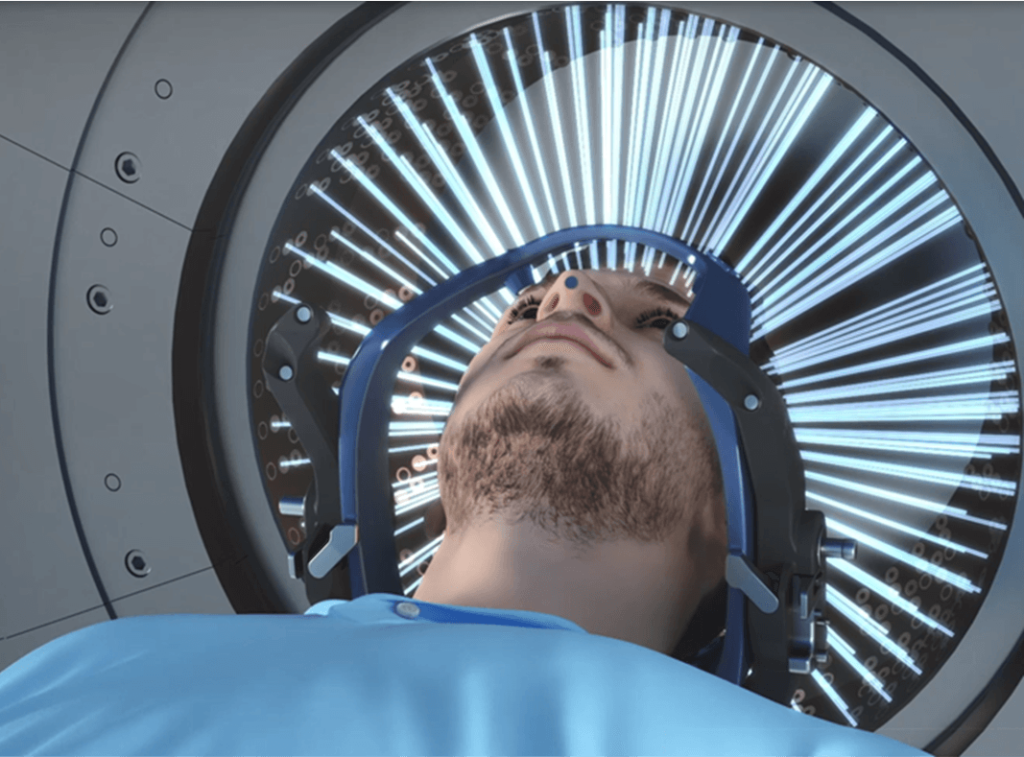 Gamma knife treatment in India 1 Gamma Knife Treatment in India